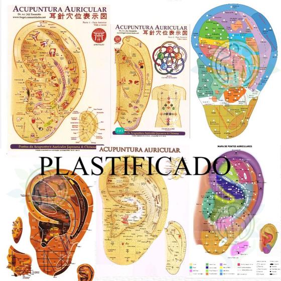 Imagem de Pacote Mapas Auricoloterapia Acupuntura Auricular Plastificados