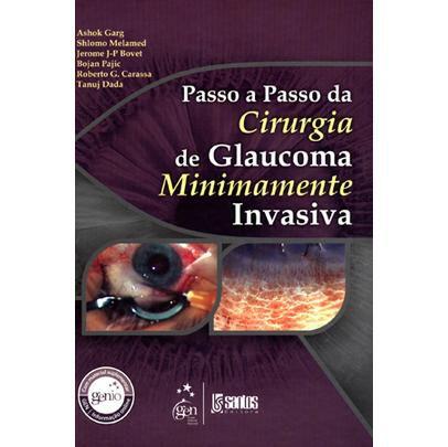 Imagem de Passo a Passo da Cirurgia de Glaucoma Minimamente Invasiva - Santos