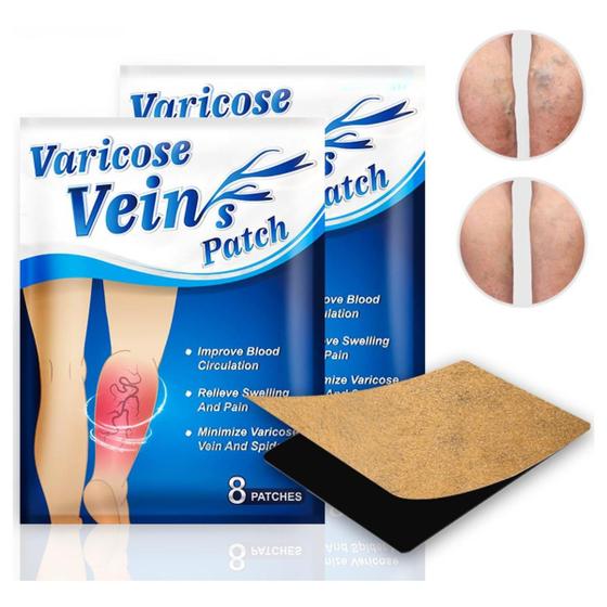 Imagem de Patch Adesivo para Varizes Varicose Veins (Azul) (2 sachês - 16 und)