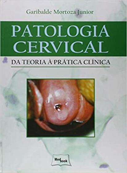 Imagem de Patologia Cervical: Da Teoria à Prática Clínica