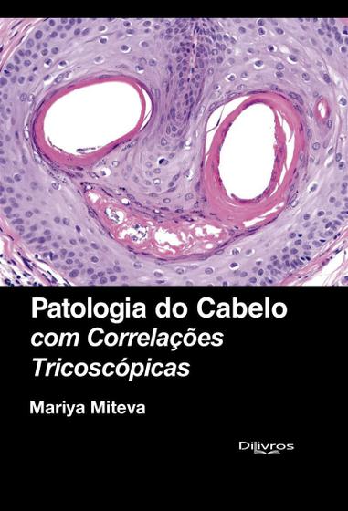 Imagem de Patologia do Cabelo com Correlações Tricoscopias - Di Livros Editora Ltda