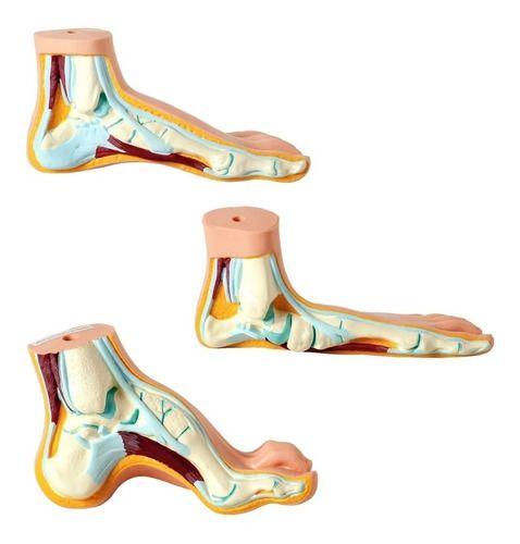Imagem de Pé 3 Modelo Anatomico Normal Chato Curvo Calcanhar Ortopedic