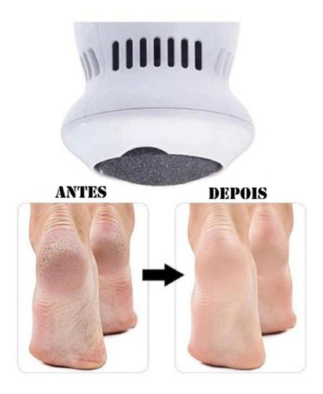 Pedi vac esfoliador lixa lixador elétrico recarregável para pés e mão Menor preço em Pedi vac esfoliador lixa lixador elétrico recarregável para pés e mão