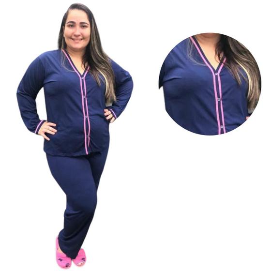 Imagem de Pijama Feminino Plus Size Americano Aberto de Botões Inverno