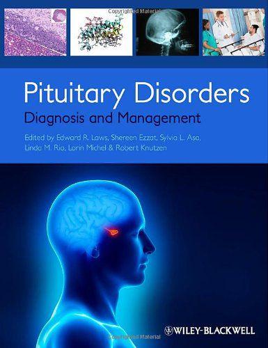 Imagem de Pituitary disorders diagnosis and management