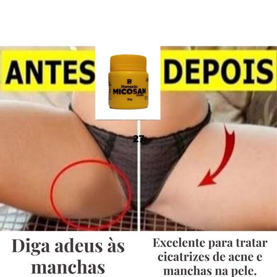 Imagem de Pomada Micosan Original Baruc Cosméticos- clareamento - clarear virilha - clareia manchas