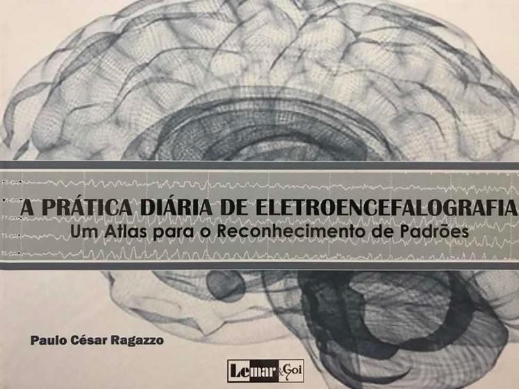 Imagem de Pratica diaria de eletroencefalografia, a: um atlas para o reconhecimento