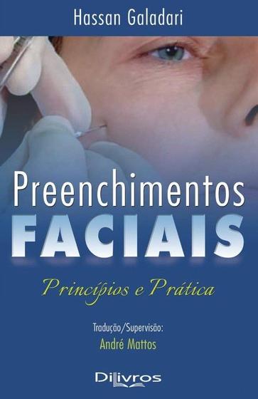 Imagem de Preenchimentos Faciais: Principios e Pratica
