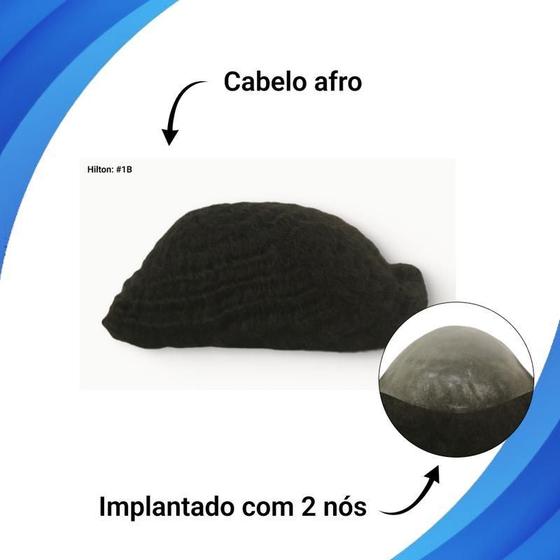 Imagem de Protese Capilar Afro Micropele Hilton 8Wv 20X25