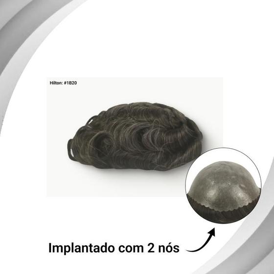 Imagem de Protese Hilton micropele capilar 20x25
