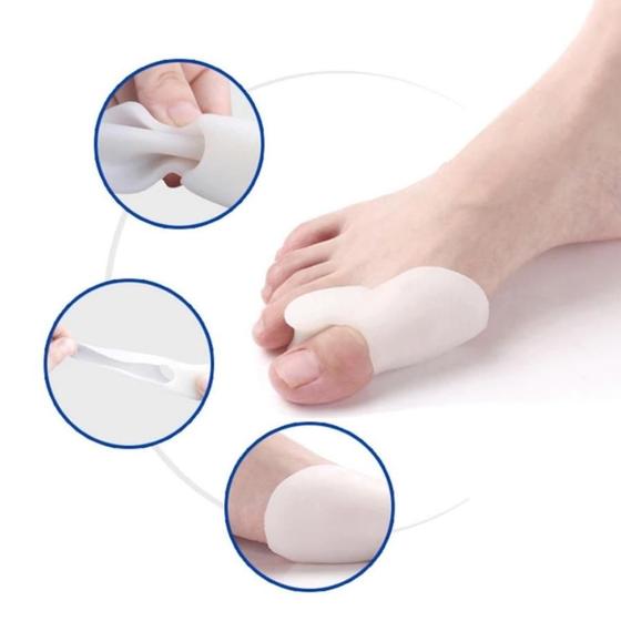 Imagem de Protetor Corretor Para Pe Joanetes Silicone