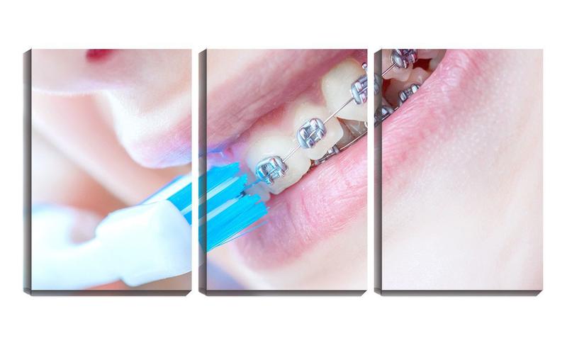 Imagem de Quadro canvas 55x110 aparelho dentário dentista