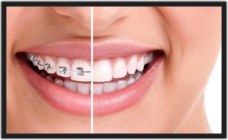 Quadro Decorativo Consultórios Odontologia Dentista Dentes Sorriso Estética Com Moldura TT10 Menor preço em Quadro Decorativo Consultórios Odontologia Dentista Dentes Sorriso Estética Com Moldura TT10