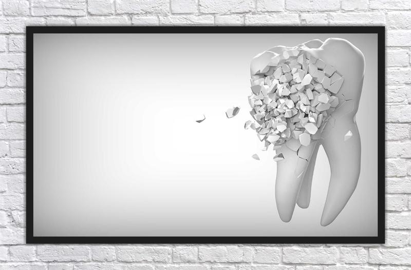 Quadro Decorativo Consultórios Odontologia Dentista Dentes Sorriso Estética Com Moldura TT11 Menor preço em Quadro Decorativo Consultórios Odontologia Dentista Dentes Sorriso Estética Com Moldura TT11