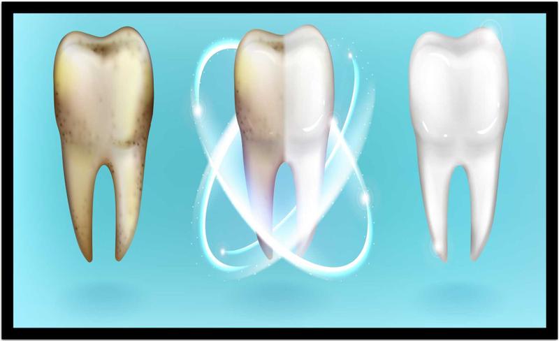 Imagem de Quadro Decorativo Dentista Limpeza Dentes Odontologia Consultórios Salas Com Moldura RC006