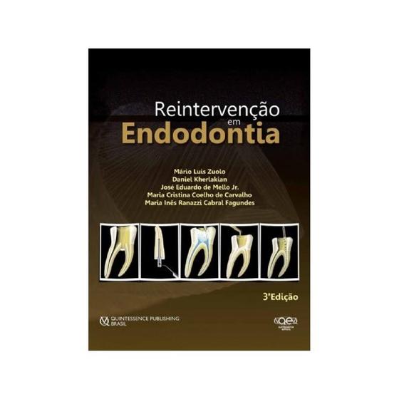 Imagem de Reintervenção em Endodontia - Quintessence nacional