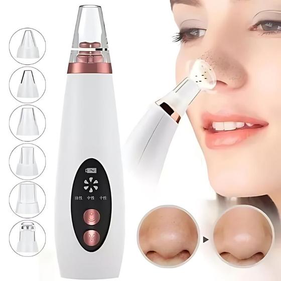 Imagem de Removedor de Cravos e Acne com Sucção Recarregável
