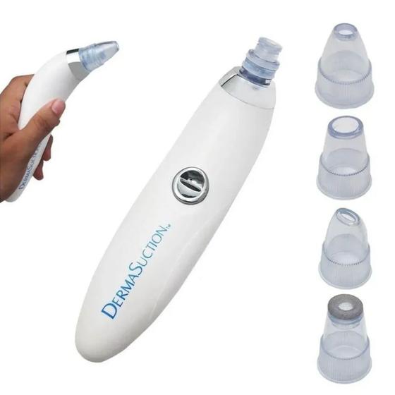 Imagem de Removedor de Cravos e Espinhas 4 em 1 Derma Suction - Vision