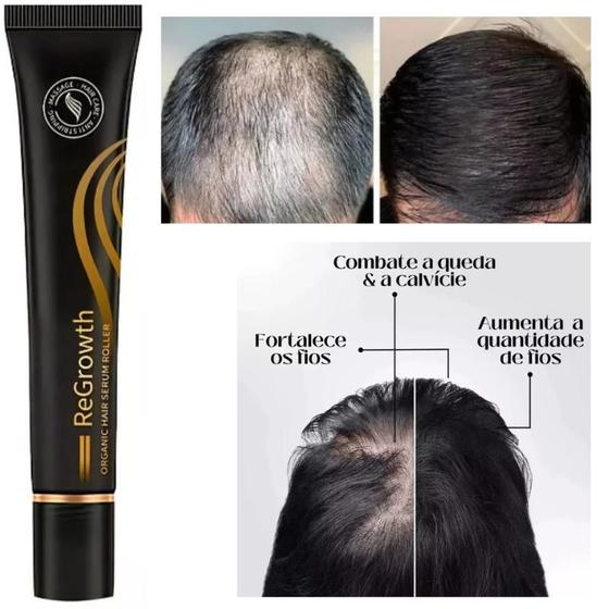 Imagem de Repair Hair 20ml Sérum Anti Calvíce Hair Regrowth Original