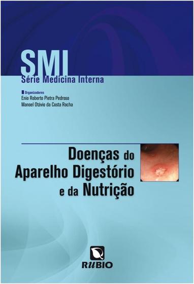 Imagem de SMI  Série Medicina Interna  Doenças do Sistema Digestório e da Nutrição - LIVRARIA E EDITORA RUBIO LTDA