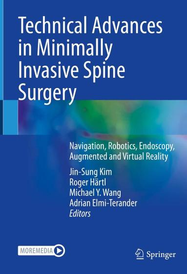 Imagem de Technical advances in minimally invasive spine surgery