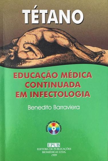 Imagem de Tetano Educaçao Medica Continuada Em Infectologia