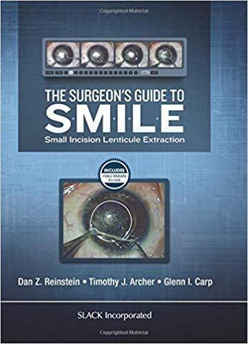 Imagem de The surgeons guide to smile: small incision lenticule extraction