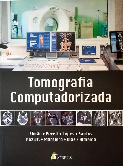 Imagem de Tomografia Computadorizada - 1ª Edição 2021 - Editora Corpus