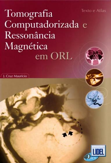 Imagem de Tomografia Computadorizada e Ressonância Magnética em Orl