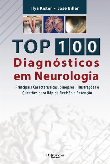 Imagem de Top 100 Diagnostico em Neurologia