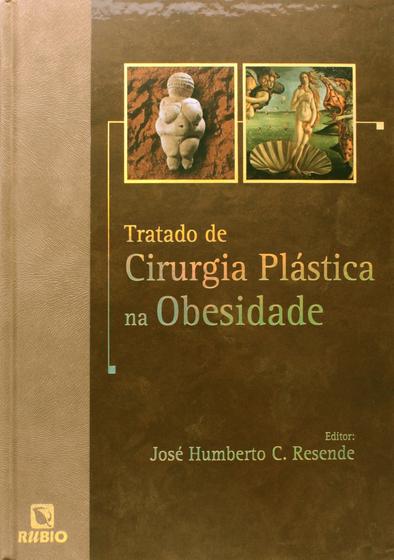 Imagem de Tratado de Cirurgia Plástica na Obesidade - Rubio