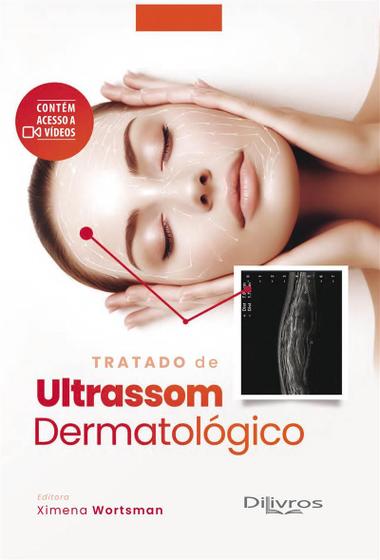 Imagem de Tratado de Ultrassom Dermatológico