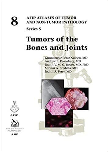 Imagem de Tumors of the bones and joints