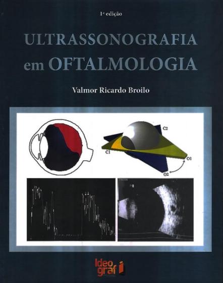 Imagem de Ultrassonografia em oftalmologia - JEFTE