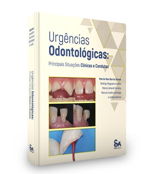 Imagem de Urgências odontológicas: principais situações clínicas e condutas - Santos Publicações