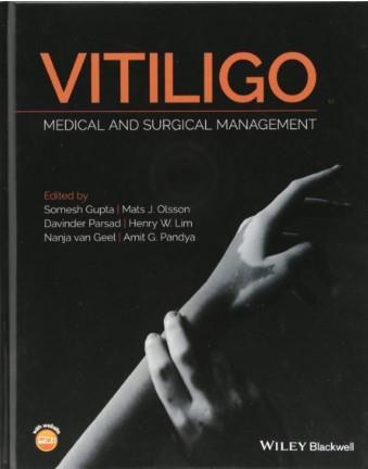 Imagem de Vitiligo: medical and surgical management