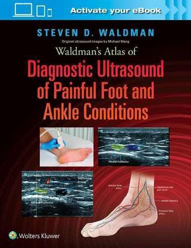 Imagem de Waldman s Atlas of Diagnostic Ultrasound of Painful Foot And Ankle Conditions - Lippincott