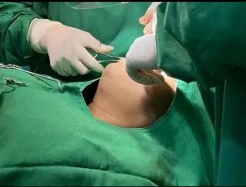 Imagem de 2 Campos Odontológicos Cirurgico Paciente Fenestrado de tecido Brim leve 100% Algodão Verde