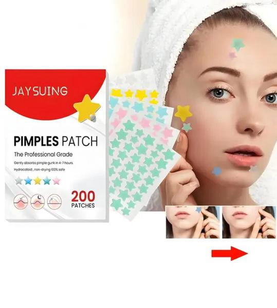 Imagem de 200x Adesivo Secante P/ Acne E Espinhas - Estrelas Coloridas