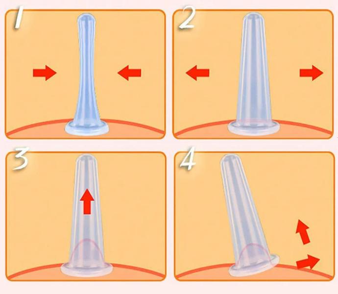 Imagem de 3 Cupping Ventosa Silicone Massagem Ventosaterapia