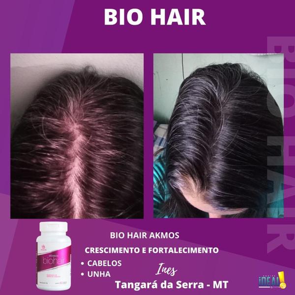 Imagem de 4X  Biohair Biotina Akmos Crescimento Do Cabelo, Fortalece Unhas E Pele