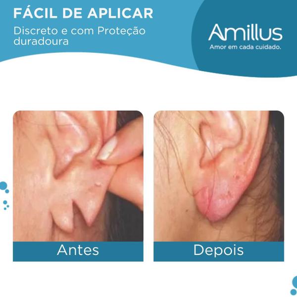 50 Adesivos Tapa Furo Cicatricur Protetor Orelhas Rasgadas - Divas Mali Boutique Imagem de 50 Adesivos Tapa Furo Cicatricur Protetor Orelhas Rasgadas
