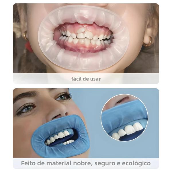 Imagem de Abridores De Boca De Borracha Descartáveis Odontológicos Estéreis 10 Peças Retrator Expansor De