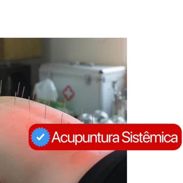 Agulha Acupuntura 30x125mm Cx 1000 Uni - Gold - GoldLife - GL Imagem de Agulha Acupuntura 30x125mm Cx 1000 Uni - Gold