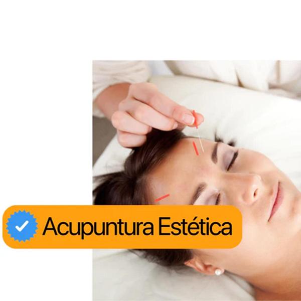 Agulha Acupuntura 30x60 Kit 3 cx 3000 Un Pcte - Gold - GoldLife - GL Imagem de Agulha Acupuntura 30x60 Kit 3 cx 3000 Un Pcte - Gold