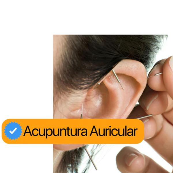 Agulha Acupuntura 30x60 Kit 3 cx 3000 Un Pcte - Gold - GoldLife - GL Imagem de Agulha Acupuntura 30x60 Kit 3 cx 3000 Un Pcte - Gold