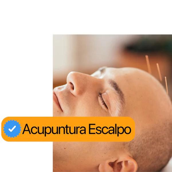 Agulha Acupuntura 30x60 Kit 3 cx 3000 Un Pcte - Gold - GoldLife - GL Imagem de Agulha Acupuntura 30x60 Kit 3 cx 3000 Un Pcte - Gold
