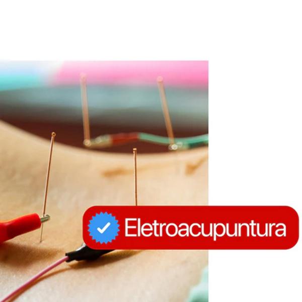 Agulha Acupuntura 30x60 Kit 3 cx 3000 Un Pcte - Gold - GoldLife - GL Imagem de Agulha Acupuntura 30x60 Kit 3 cx 3000 Un Pcte - Gold