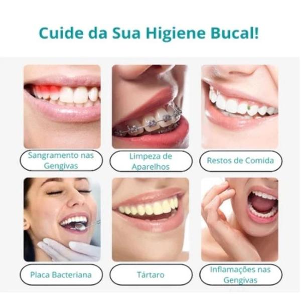 Imagem de Aparelho De Limpeza De Prótese Protocolo Com Água Dental