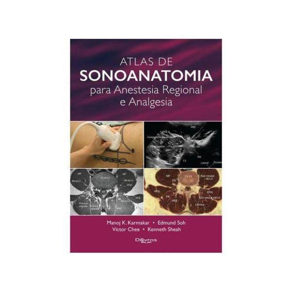 Imagem de Atlas De Sonoanatomia Para Anestesia Regional E Analgesia